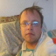 André 1